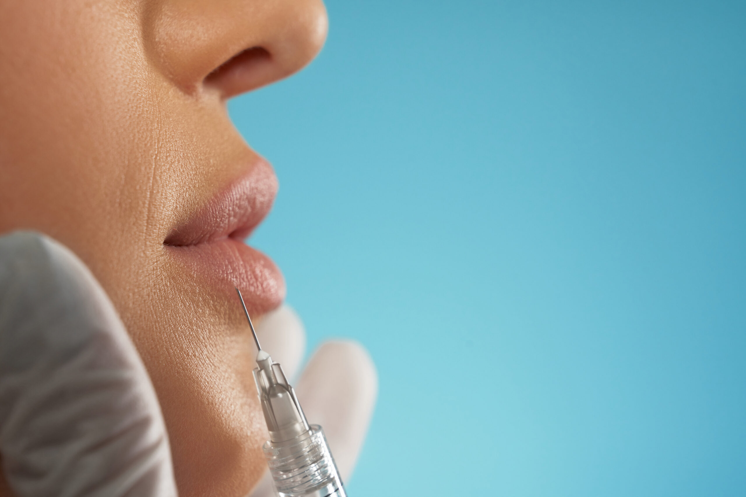 Preenchimento Labial MK Clinica