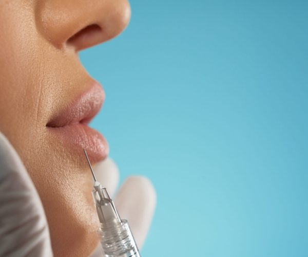 Preenchimento Labial MK Clinica
